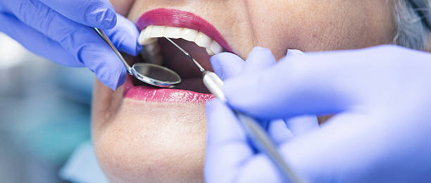 Best Emergency Denture Repair in Lloyd Harbor, NY